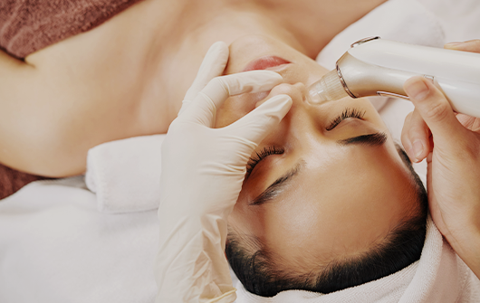 毛穴エクストラクション